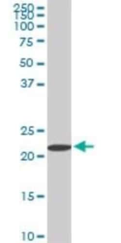 RPS7 Antibody (3G4), Novus Biologicals 0.1 mg | Buy Online | Novus Biologicals | Fisher Scientific