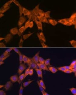 RPSA Rabbit anti-Human, Mouse, Rat, Clone: 2Q8Q6, Novus Biologicals 20 &mu;g | Buy Online | Novus Biologicals | Fisher Scientific