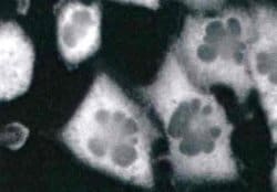 RPSA Antibody (RP-01) - BSA Free, Novus Biologicals 0.1 mg | Buy Online | Novus Biologicals | Fisher Scientific