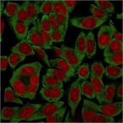 RPSA Antibody (RPSA/2699) - Azide and BSA Free, Novus Biologicals 100 ug;