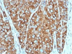 RPSA Antibody (RPSA/2699) - Azide and BSA Free, Novus Biologicals 100 ug;