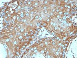 RPSA Antibody (RPSA/2699) - Azide and BSA Free, Novus Biologicals 100 ug;