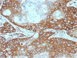 RPSA Antibody (RPSA/2699) - Azide and BSA Free, Novus Biologicals 100 ug;