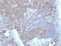 RPSA Antibody (RPSA/2699) - Azide and BSA Free, Novus Biologicals 100 ug;