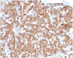 RPSA Rabbit anti-Human, Clone: RPSA/6332R, Novus Biologicals:Antibodies:Primary