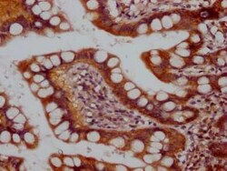 RPTOR Antibody (1B10), Novus Biologicals 100 &mu;g; Unconjugated:Antibodies,