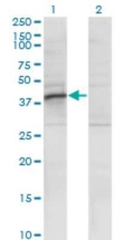 RRAGB Antibody (2B8), Novus Biologicals 0.1 mg | Buy Online | Novus Biologicals | Fisher Scientific
