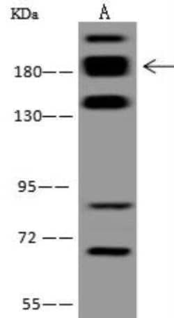 RREB1 Antibody, Novus Biologicals 100 &mu;g; Unconjugated:Antibodies, Polyclonal