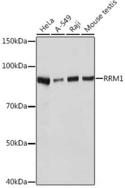 RRM1 Rabbit anti-Human, Mouse, Rat, Clone: 4P4U1, Novus Biologicals 20 &mu;g | Buy Online | Novus Biologicals | Fisher Scientific
