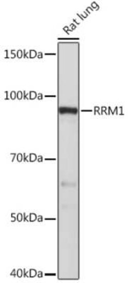 RRM1 Rabbit anti-Human, Mouse, Rat, Clone: 4P4U1, Novus Biologicals 20 &mu;g | Buy Online | Novus Biologicals | Fisher Scientific