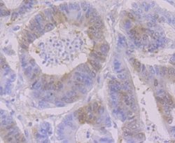 RRM1 Rabbit anti-Human, Mouse, Clone: JB09-43, Novus Biologicals 100 &mu;l;
