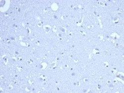 RRM1 Rabbit anti-Human, Clone: RRM1/4372R, Novus Biologicals:Antibodies:Primary