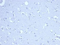 RRM1 Antibody (RRM1/4372R) - Azide and BSA Free, Novus Biologicals 100 &mu;g | Buy Online | Novus Biologicals | Fisher Scientific