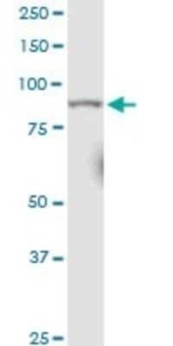 RRM1 Antibody (1D6), Novus Biologicals 0.1 mg | Buy Online | Novus Biologicals | Fisher Scientific