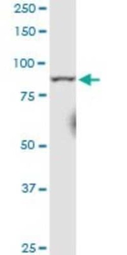 RRM1 Antibody (2D11), Novus Biologicals 0.1 mg | Buy Online | Novus Biologicals | Fisher Scientific
