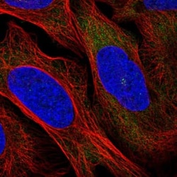 RRM1 Antibody, Novus Biologicals:Antibodies:Primary Antibodies