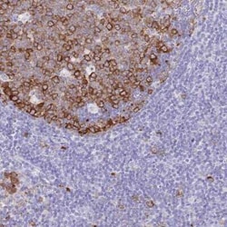 RRM1 Antibody, Novus Biologicals:Antibodies:Primary Antibodies
