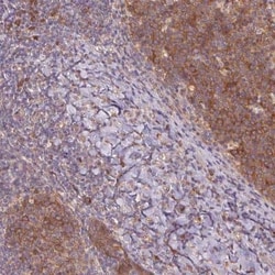 RRM1 Antibody, Novus Biologicals:Antibodies:Primary Antibodies