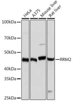 RRM2 Rabbit anti-Human, Mouse, Rat, Clone: 10Y6E4, Novus Biologicals 100