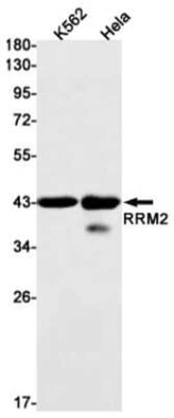 RRM2 Rabbit anti-Human, Clone: S09-4G8, Novus Biologicals 100 &mu;g; Unconjugated:Antibodies,