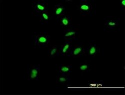RRN3 Antibody, Novus Biologicals 0.05 mg | Buy Online | Novus Biologicals | Fisher Scientific