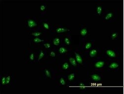 RRP1 Antibody, Novus Biologicals 0.05 mg | Buy Online | Novus Biologicals | Fisher Scientific