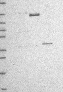 RRP12 Rabbit anti-Human, Polyclonal, Novus Biologicals:Antibodies:Primary