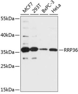 RRP36 Antibody - Azide and BSA Free, Novus Biologicals 0.02 mL | Buy Online | Novus Biologicals | Fisher Scientific
