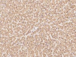 RRP4 Antibody, Novus Biologicals:Antibodies:Primary Antibodies