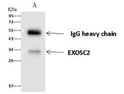 RRP4 Antibody, Novus Biologicals:Antibodies:Primary Antibodies