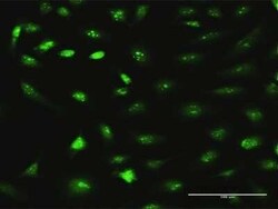 RRS1 Antibody, Novus Biologicals 0.1 mg | Buy Online | Novus Biologicals | Fisher Scientific