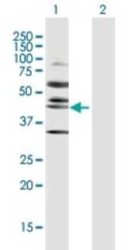 RRS1 Antibody, Novus Biologicals 0.1 mg | Buy Online | Novus Biologicals | Fisher Scientific