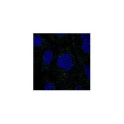RSAD1 Rabbit anti-Human, Polyclonal, Novus Biologicals 25 &mu;g; Unconjugated:Antibodies,
