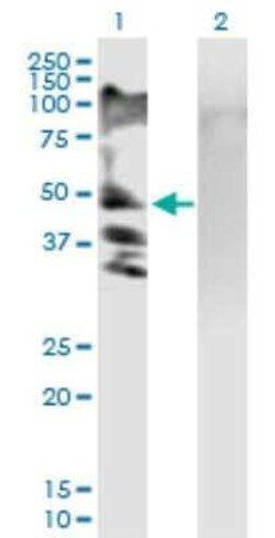 RSC1A1 Antibody, Novus Biologicals 50 &mu;g | Buy Online | Novus Biologicals | Fisher Scientific