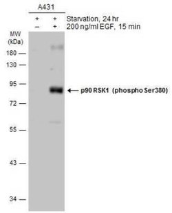 RSK1, p Ser380 Antibody, Novus Biologicals 100 &mu;g | Buy Online | Novus Biologicals | Fisher Scientific