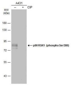 RSK1, p Ser380 Antibody, Novus Biologicals 100 &mu;g | Buy Online | Novus Biologicals | Fisher Scientific