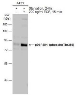 RSK1, p Thr359 Antibody, Novus Biologicals 100 &mu;g | Buy Online | Bio-Techne | Fisher Scientific