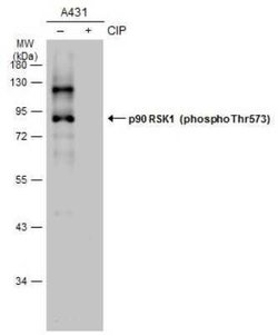 RSK1, p Thr573 Antibody, Novus Biologicals 100 &mu;g | Buy Online | Novus Biologicals | Fisher Scientific