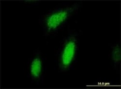 RSK2 Antibody (2G10), Novus Biologicals 0.1 mg | Buy Online | Novus Biologicals | Fisher Scientific