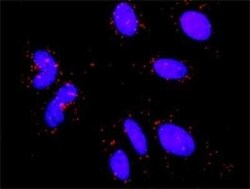 RSK2 Antibody (2G10), Novus Biologicals 0.1 mg | Buy Online | Novus Biologicals | Fisher Scientific