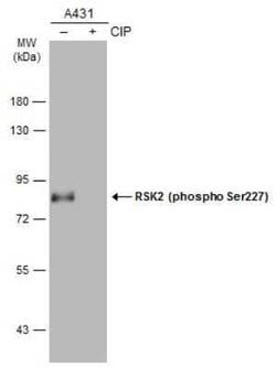 RSK2, p Ser227 Antibody, Novus Biologicals 100 &mu;g | Buy Online | Novus Biologicals | Fisher Scientific
