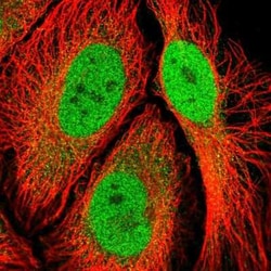 RSK3 Antibody, Novus Biologicals:Antibodies:Primary Antibodies