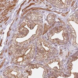 RSK3 Antibody, Novus Biologicals:Antibodies:Primary Antibodies