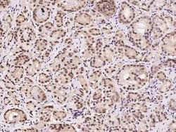 RSK3 Antibody, Novus Biologicals 50 &mu;g, Unconjugated:Antibodies, Polyclonal