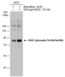 RSK3, p Ser360, p Thr356 Antibody, Novus Biologicals 100 &mu;g | Buy Online | Novus Biologicals | Fisher Scientific