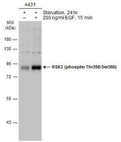 RSK3, p Thr356, p Ser360 Antibody, Novus Biologicals 100 &mu;g | Buy Online | Novus Biologicals | Fisher Scientific