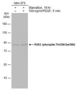 RSK3, p Thr356, p Ser360 Antibody, Novus Biologicals 100 &mu;g | Buy Online | Novus Biologicals | Fisher Scientific
