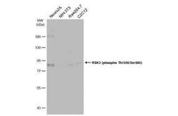 RSK3, p Thr356, p Ser360 Antibody, Novus Biologicals 100 &mu;g | Buy Online | Novus Biologicals | Fisher Scientific
