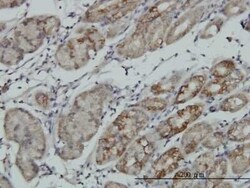 RSK4 Antibody (8E8), Novus Biologicals 0.1 mg | Buy Online | Novus Biologicals | Fisher Scientific