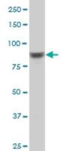 RSK4 Antibody (8E8), Novus Biologicals 0.1 mg | Buy Online | Novus Biologicals | Fisher Scientific